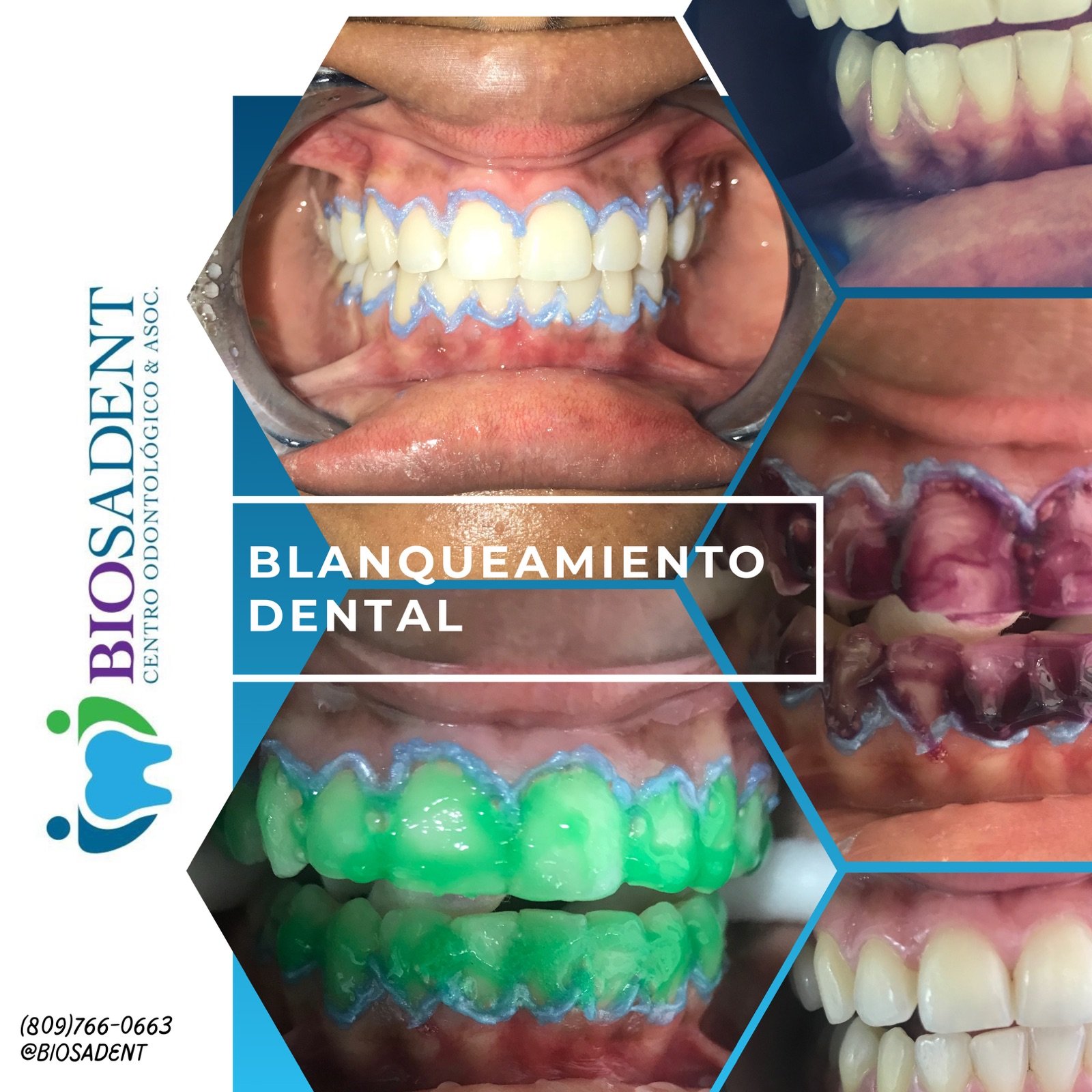 23e1496c-17cb-45b9-b356-0ce0bda614ca