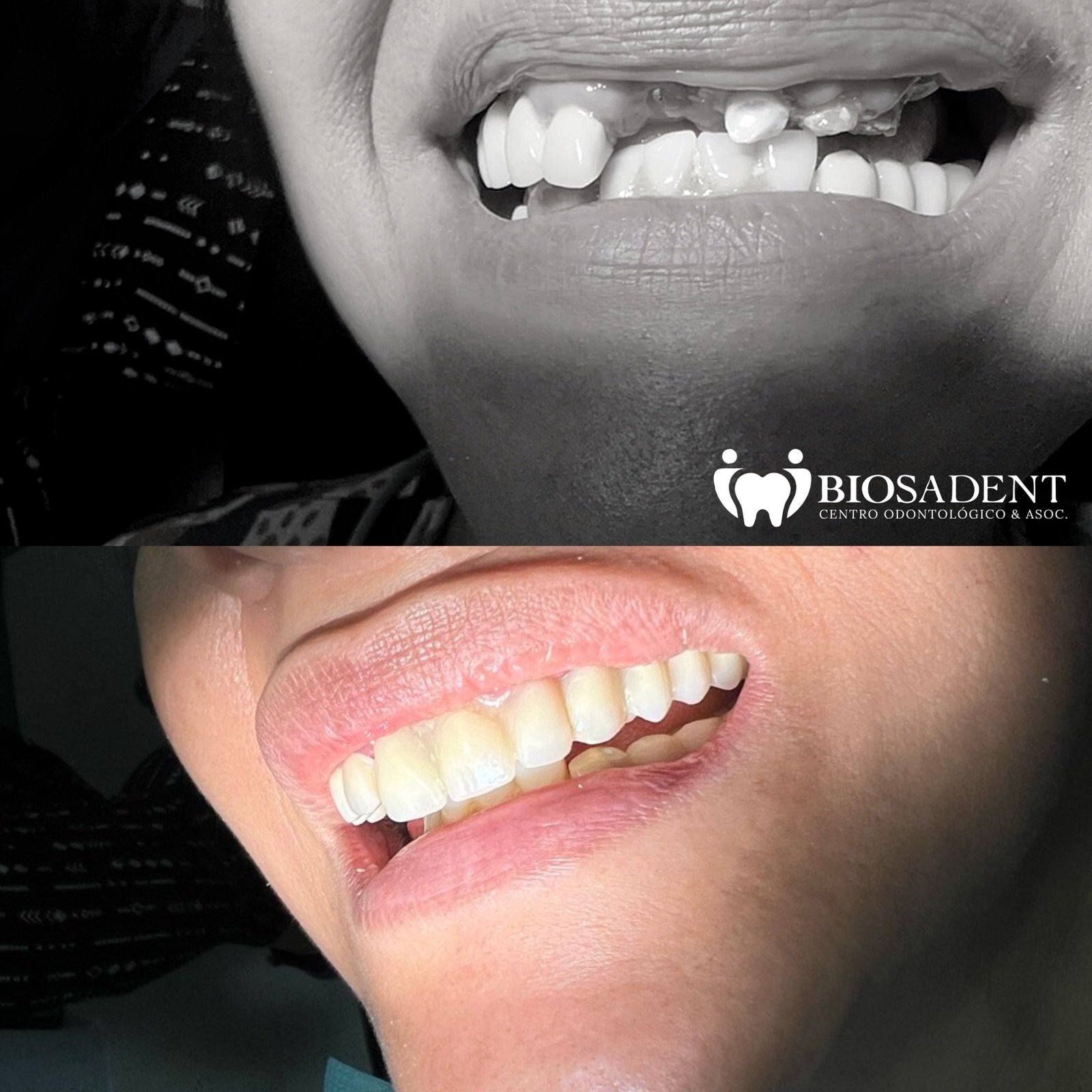 Rehabilitación Oral